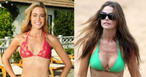 Denise Richards Before and After Breast Implants
