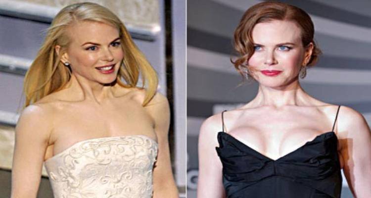 Nicole Kidman Before and After Breast Implants