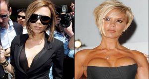 Victoria Beckham Before and After Breast Implants