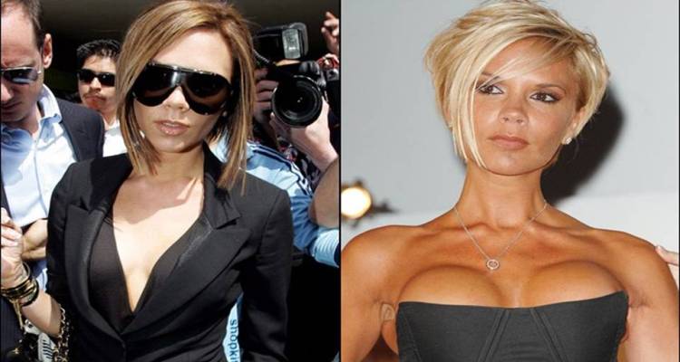 Victoria Beckham Before and After Breast Implants