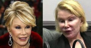 The Information About Joan Rivers Plastic Surgery You Should Know