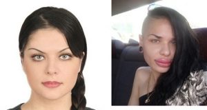 Kristina Rei Before and After Lip Injections