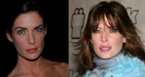 Lara Flynn Boyle Before and After Lip Injections