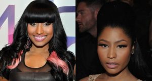 Issue of Nicki Minaj Plastic Surgery