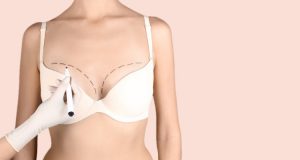 How Much is Breast Augmentation? Read This to Know the Answer