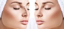 How Much is Rhinoplasty Cost, and What Should You Know About It?